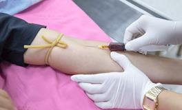 梦见自己满脸是血